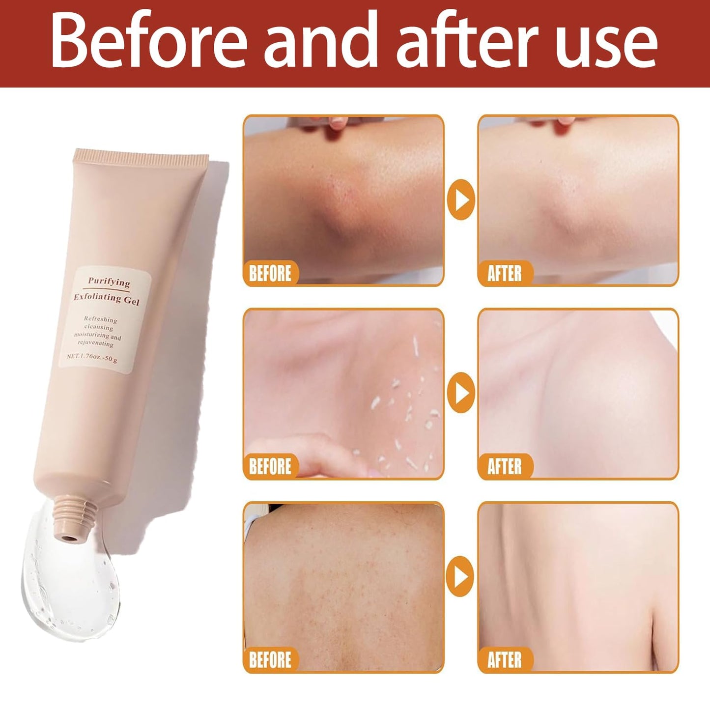 ClearSkin Exfoliating Gel - Radiant Skin in 1 minute